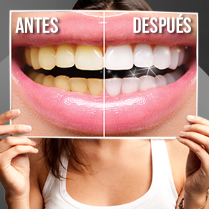 carbon activo dientes